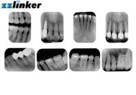 17 piccola dimensione intraorale dentaria del livello grigio del bit dell'analizzatore 14 di risoluzione di Lp/Mm